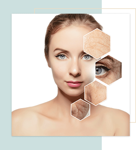 eKSeption anti aging bőrfitalalító eljárás Kistarcsa kozmetika szépségszalon
